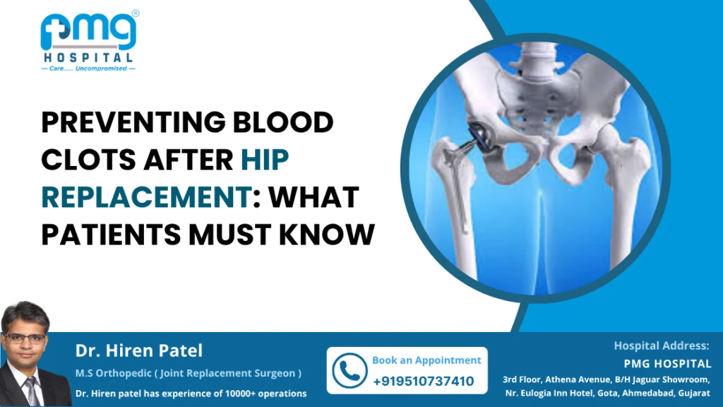 Prevent Blood Clots After Hip Replacement Surgery