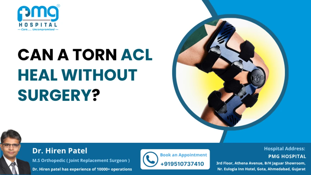 Can a Torn ACL Heal Without Surgery?