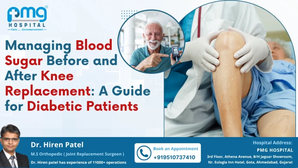 Knee Replacement Guide for Diabetic Patients