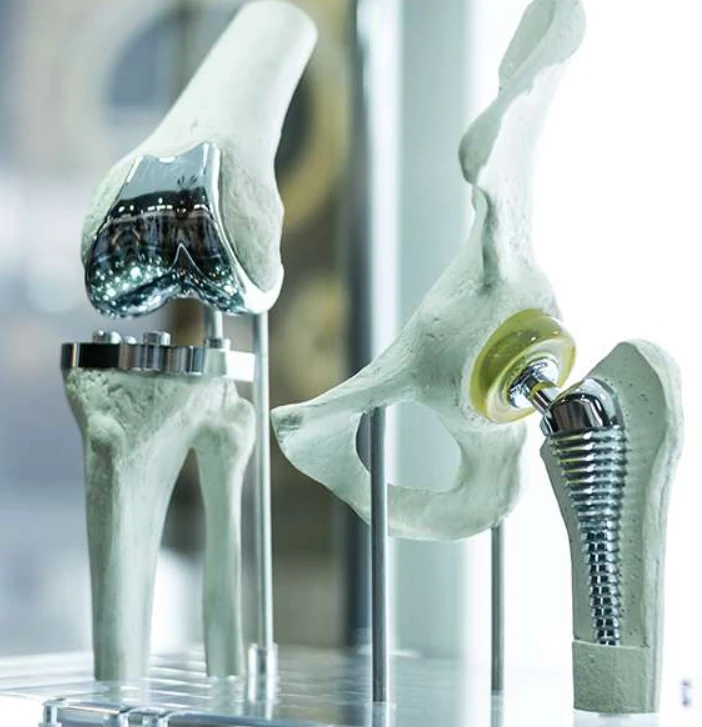 Robotic knee replacement surgery at PMG Hospital