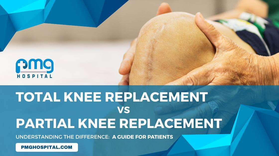 Partial and Total Knee replacement difference Blog banner