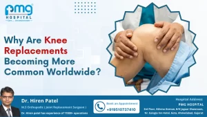 Knee Replacements Becoming Popular