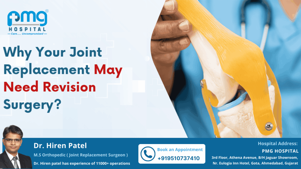 Joint Replacements Need Revision Surgery