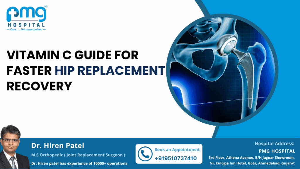 Vitamin C Guide for Hip Replacement Recovery