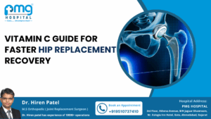 Vitamin C Guide for Hip Replacement Recovery