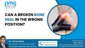 Can a Broken Bone Heal in the Wrong Position?