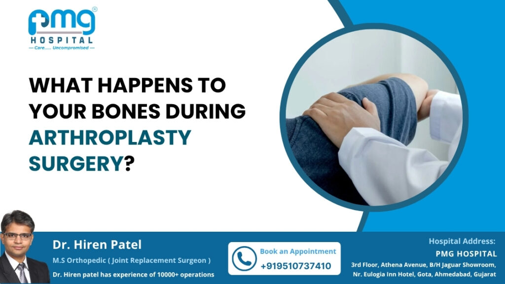 What Happens to Your Bones During Arthroplasty Surgery?