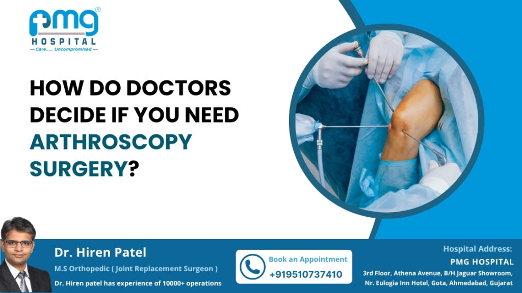 How Do Doctors Decide If You Need Arthroscopy Surgery?