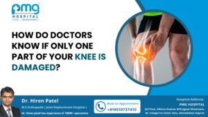 How Do Doctors Know If Only One Part of Your Knee Is Damaged?